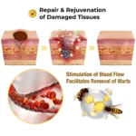 Derma-Smooth-Skin-Tag-Removal-Patches-1