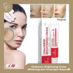 Chalonese Brightening Cream: Fade Spots & Glow