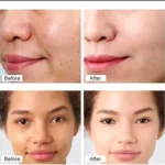 Chalonese Brightening Cream: Fade Spots & Glow