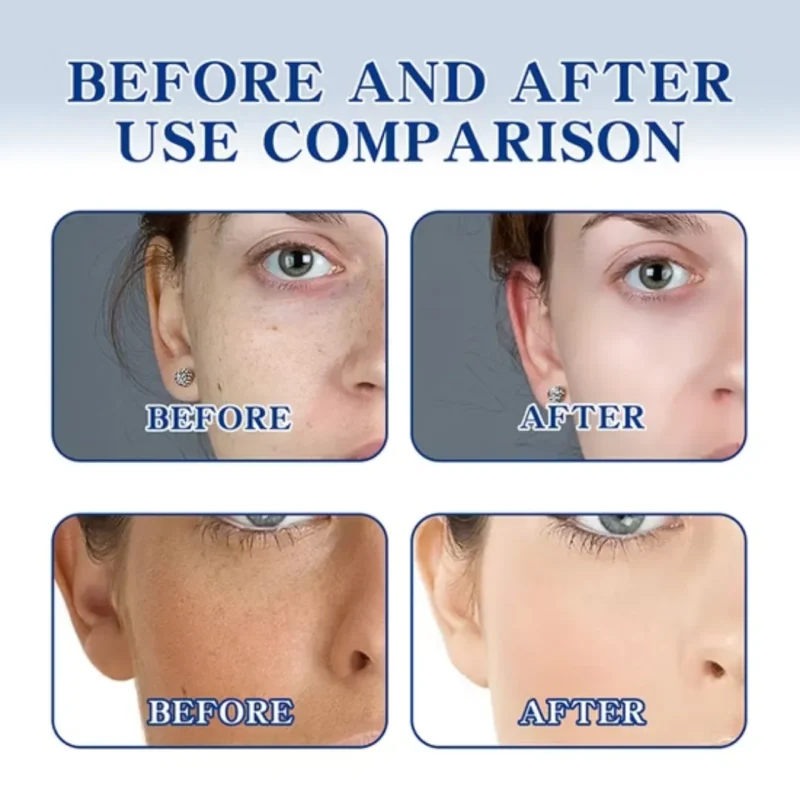 Chalonese Brightening Cream: Fade Spots & Glow