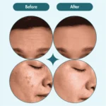 Chalonese Brightening Cream: Fade Spots & Glow