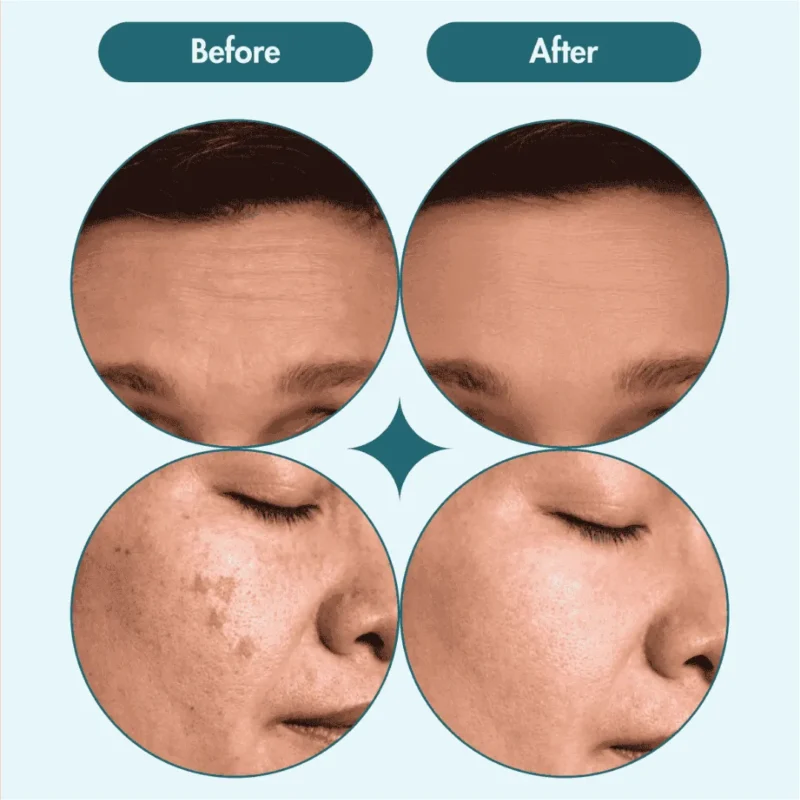 Chalonese Brightening Cream: Fade Spots & Glow