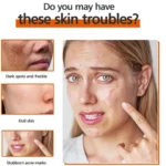 Chalonese Brightening Cream: Fade Spots & Glow