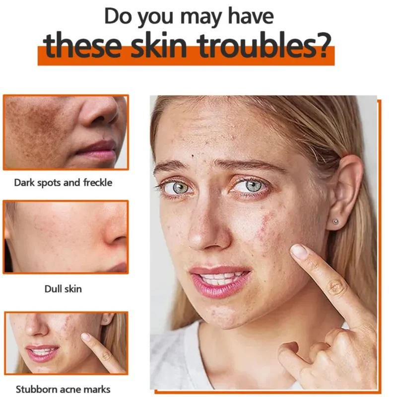 Chalonese Brightening Cream: Fade Spots & Glow