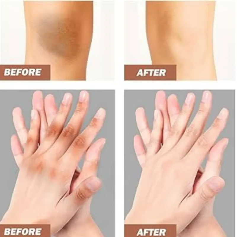 Chalonese Brightening Cream: Fade Spots & Glow