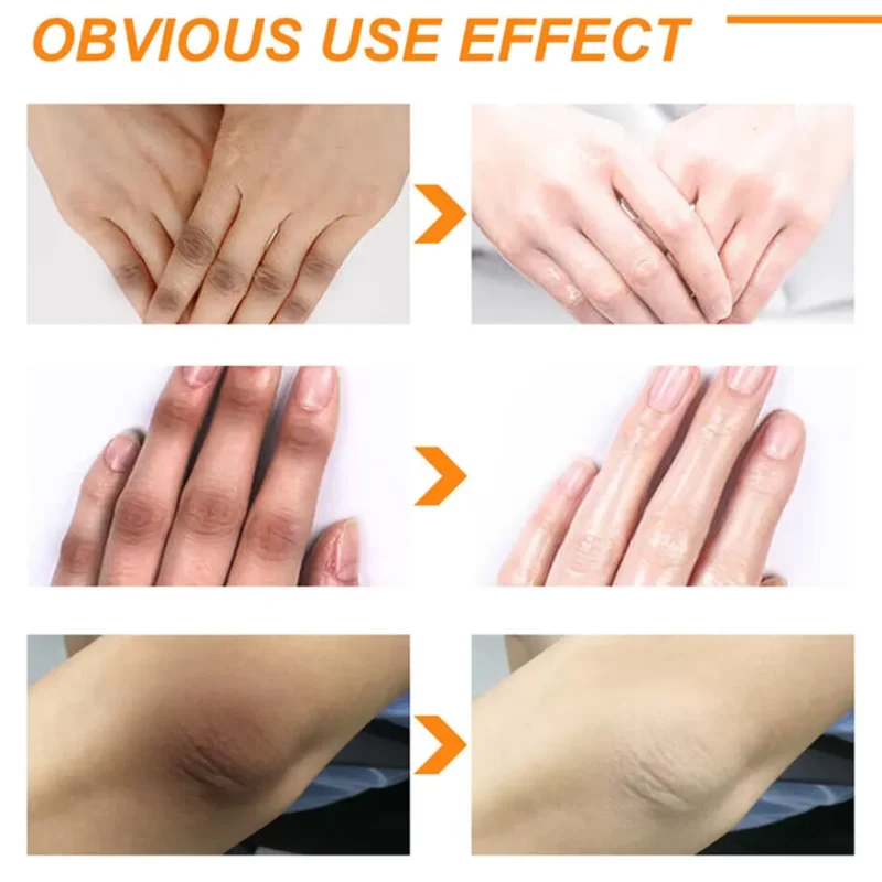 Chalonese Brightening Cream: Fade Spots & Glow