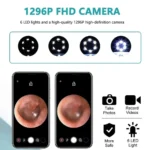 Smart Wireless Ear Cleaner with 1080P HD Camera | Fast Delivery
